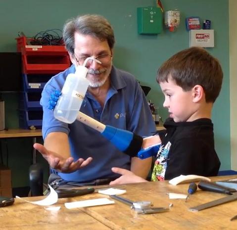 9 YEAR OLD PROSTHETIC ARM